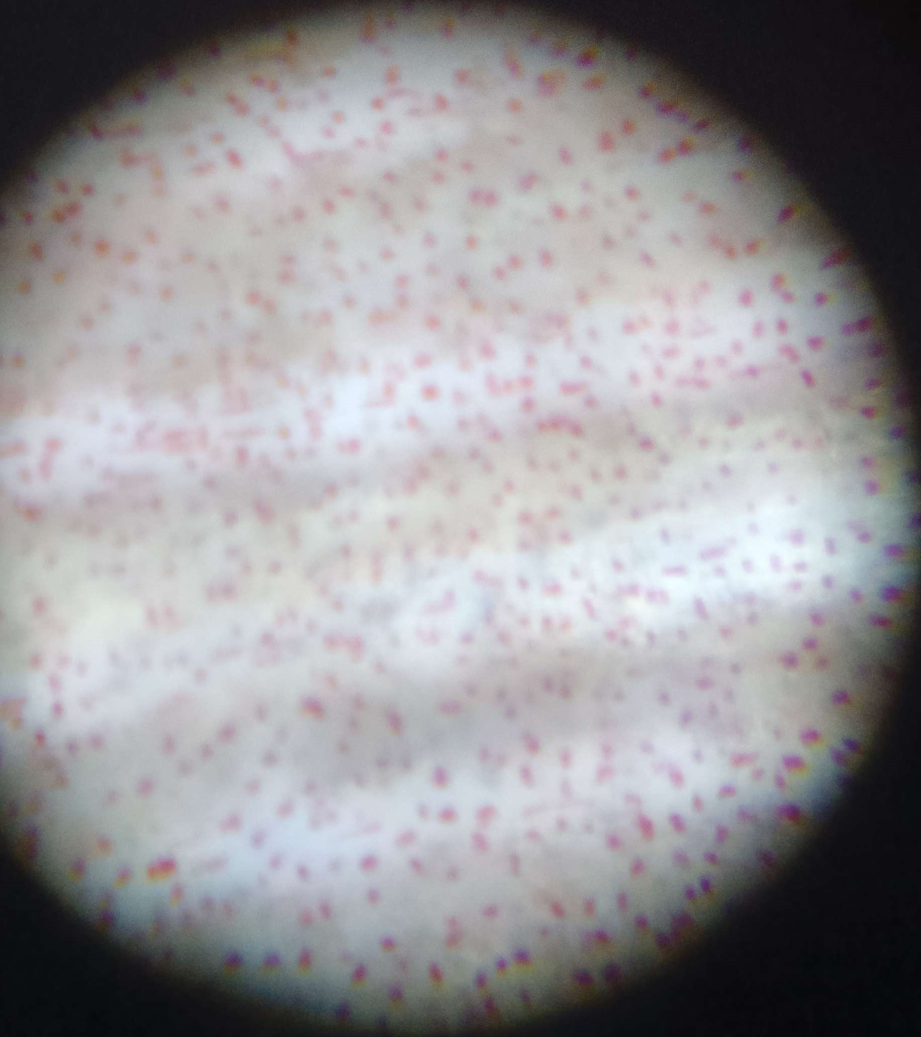 Microscope of Elephant Ear Stem